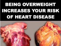 Apa Junk Food Perlu Pakai Peringatan Gambar Seram Seperti Rokok?