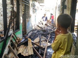 1 Anak Luka Bakar Akibat Kebakaran di Bidara Cina, Balita Trauma 1 Anak Luka Bakar Akibat Kebakaran di Bidara Cina, Balita Trauma
