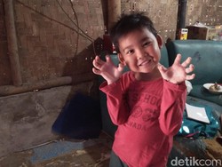 Lebaran Lebih Awal untuk Alif Bocah Viral di Tangerang