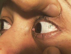 Tren Unik Tanam Perhiasan di Bola Mata