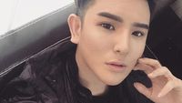 Jadi Ganteng, Penampilan Pria yang Operasi Plastik Setelah Diputusin Pacar