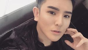 Jadi Ganteng, Penampilan Pria yang Operasi Plastik Setelah Diputusin Pacar