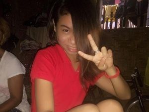 Gadis Ini Tutupi Tumor Besar di Matanya dengan Rambut