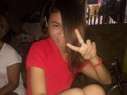 Gadis Ini Tutupi Tumor Besar di Matanya dengan Rambut