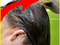 Peneliti Terkejut, Ada Metode yang Cepat Menumbuhkan Rambut