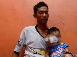 Kanker Ganas Gerogoti Separuh Wajah Bocah 3 Tahun Ini