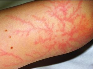 Potret Luka Langka Para Korban Sambaran Petir