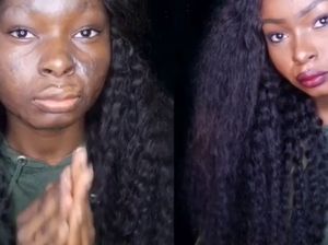 Alami Luka Bakar, Gadis Ini Jadi Viral Karena Kemampuan Make Up-nya