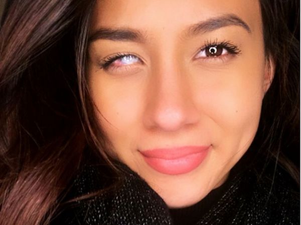 Separuh Buta Tak Hentikan Wanita Ini Wakili Australia di Ajang Miss World
