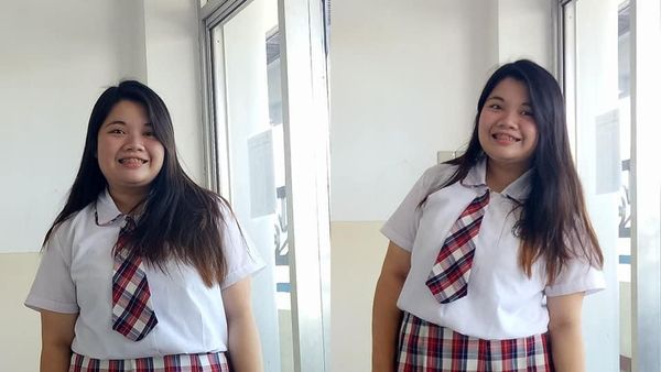 Pernah Sulit Naik Becak, Transformasi Wanita yang Turun 29 Kg Ini Buat Takjub