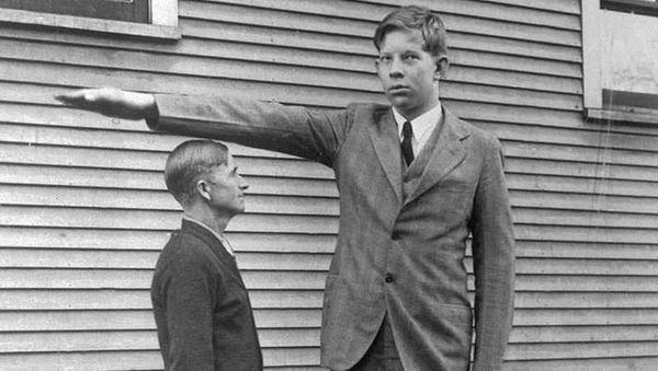 Potret Semasa Hidup Pria Paling Tinggi Dalam Sejarah