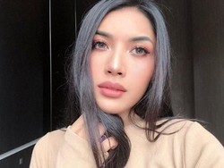 Bibir Millen Bengkak Saat Berkunjung, Aurel: Kayak Hantu Blau!