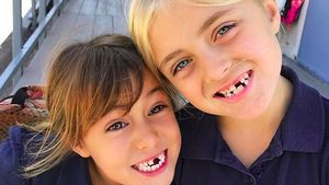 No Teeth No Cry! Anak-anak Ini Tetap Happy Meski Ompong