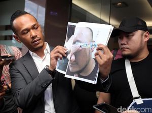 Ronny yang Mengaku Dipukul Herman Hery Diperiksa di Polres Jaksel