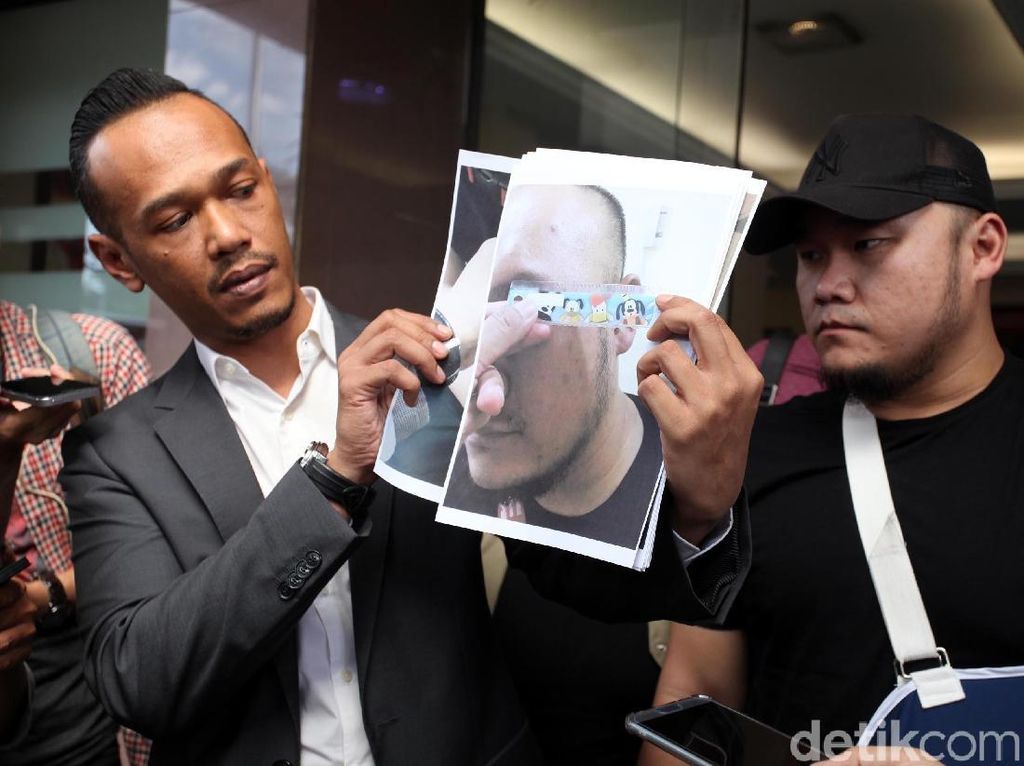 Ronny yang Mengaku Dipukul Herman Hery Diperiksa di Polres Jaksel Ronny yang Mengaku Dipukul Herman Hery Diperiksa di Polres Jaksel