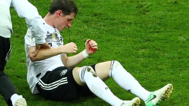 Sebastian Rudy mengalami cedera hidung setelah berbenturan dengan pemain Swedia. (