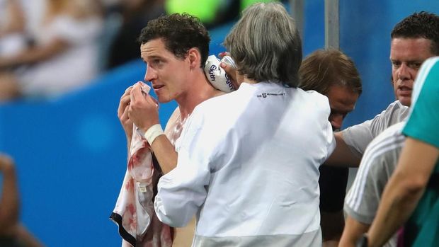 Sebastian Rudy mengalami patah hidung