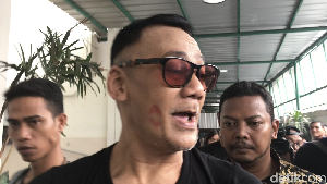 Bekas Bibir di Pipi Tio Pakusadewo