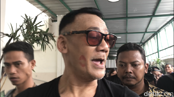 Bekas Bibir di Pipi Tio Pakusadewo