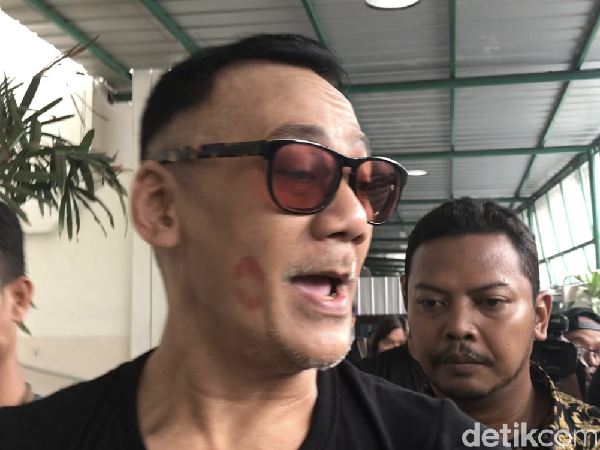 Bekas Bibir di Pipi Tio Pakusadewo