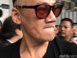 Ada Bibir Merah di Pipi Tio Pakusadewo saat Tiba di PN Jaksel