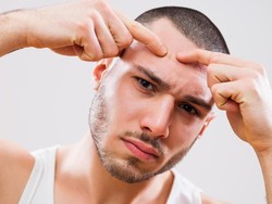 Awas! Pencet Jerawat Sembarangan Bisa Berujung Kematian