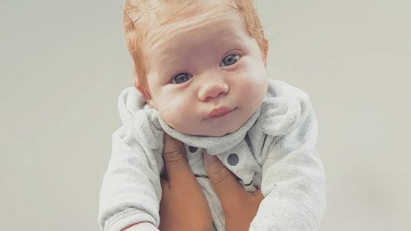 Potret Menggemaskan Bayi Berambut Merah