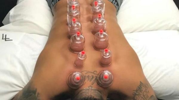Dari Neymar Hingga Michael Phelps, Deretan Atlet yang Doyan Terapi Bekam