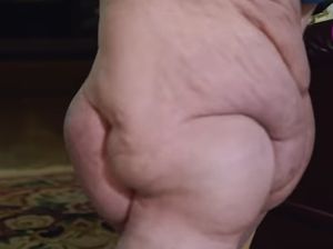 Wanita Ini Punya Satu Kaki Terbesar di Dunia, Beratnya 68 Kg