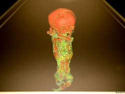 Hologram di Museum Jerman Ungkap Misteri di Balik Mumi