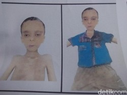 Mayat Dalam Plastik, Polisi: Korban Derita Bawah Garis Merah