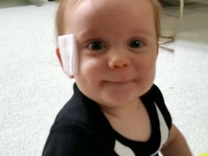 Cerita Bayi yang Wajahnya Terluka Gara-gara Empeng