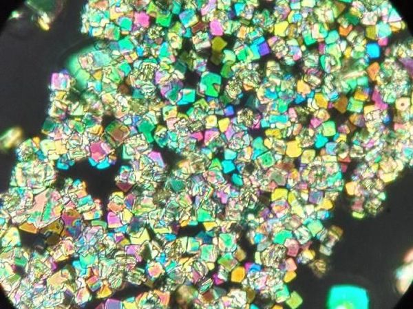 Cantik Tapi Berbahaya, Potret Kristal Asam Urat di Bawah Lensa Mikroskop