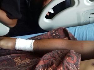 Keluarga Yakin Rizky Mati Suri Dipatuk King Cobra, Ini Respons RS Keluarga Yakin Rizky Mati Suri Dipatuk King Cobra, Ini Respons RS