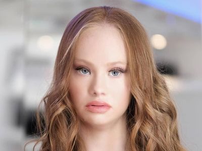 Cantiknya Maddy, Model Profesional Pertama dengan Down Syndrome