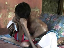 Tolong! Bocah Penderita Kanker Otot Ini Butuh Uluran Tangan