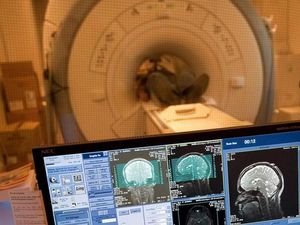 Apa Definisi Kematian Menurut Dunia Kedokteran?