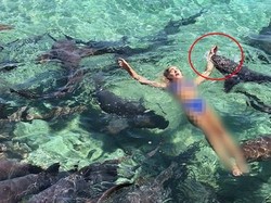 Ngeri! Selebgram Digigit Hiu Saat Liburan Bareng Pacar di Bahama