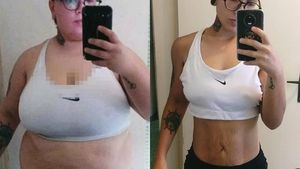 Pernah Gemuk Tidak Berleher, Wanita Ini Sekarang Jadi Model Seksi