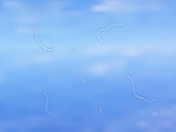 Sering Melihat Bintik Putih Mengambang di Mata? Ini Alasannya