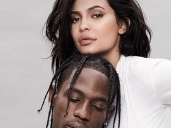 Cerita di Balik Luka Paha Kylie Jenner yang Terpampang di Sampul Majalah