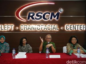 RSCM Peringati Bulan Kewaspadaan Bibir dan Lelangit Sumbing