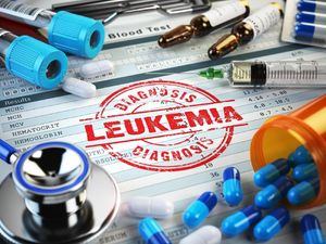 Leukemia Akut, Kanker Darah yang Lebih Banyak Menyerang Orang Dewasa Leukemia Akut, Kanker Darah yang Lebih Banyak Menyerang Orang Dewasa