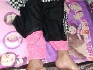 Siswi SMA Lumpuh Akibat Squat Jump, Sekolah Dinilai Lalai Siswi SMA Lumpuh Akibat Squat Jump, Sekolah Dinilai Lalai
