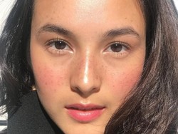 Freckles Lagi Ngetren, Bagaimana Cara Alami Mendapatkan Wajah Berbintik?
