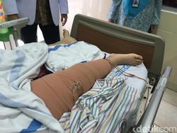 Hari Tulang dan Sendi Anak Sedunia 19 Oktober serta Osteosarkoma di Indonesia