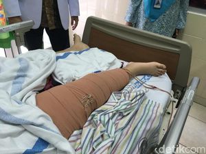 Kanker Tulang: Penyebab, Gejala, Jenis, dan Cara Pengobatannya Kanker Tulang: Penyebab, Gejala, Jenis, dan Cara Pengobatannya