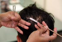 Rambut Sering Rontok Usai Melahirkan, Bun? Begini Cara Mengatasinya
