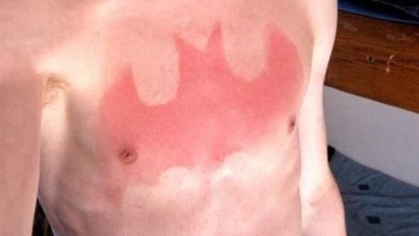 Foto-foto Ini Buktikan Matahari Bisa Jadi Ahli Tato yang Keren Tapi Seram