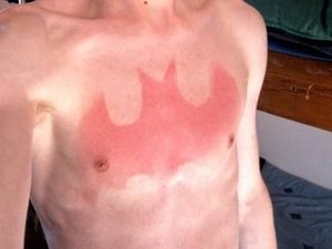 Foto-foto Ini Buktikan Matahari Bisa Jadi Ahli Tato yang Keren Tapi Seram